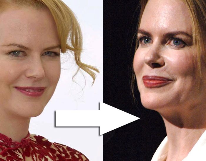 Nicole Kidman, dieci anni dopo