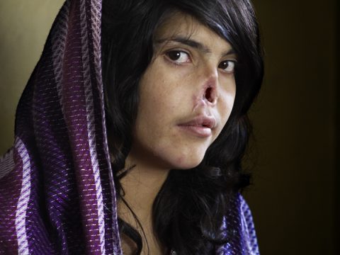 World Press Photo 2011: vince Bibi, l'afghana sfigurata
