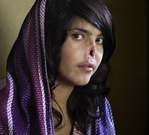 World Press Photo 2011: vince Bibi, l'afghana sfigurata