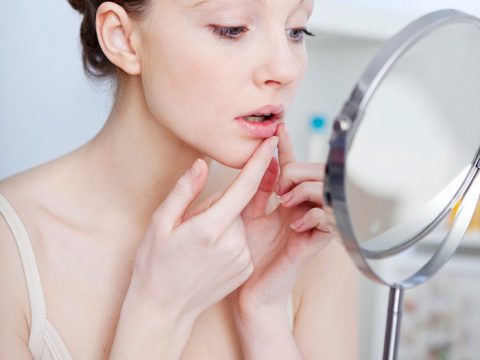 Herpes labiale: come sconfiggerlo e prevenirlo