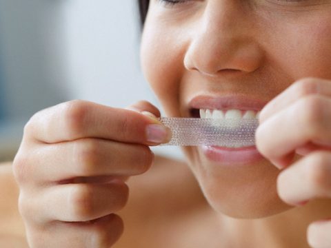 Tutti i rimedi per avere denti più bianchi