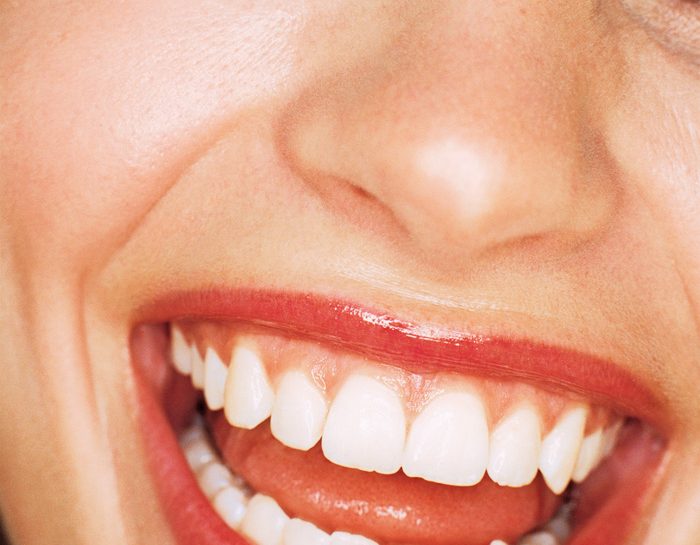 Per la salute del cavo orale, aumenta la vitamina C