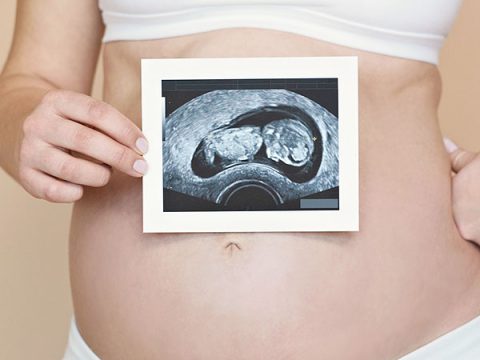 Le posizioni del feto in gravidanza