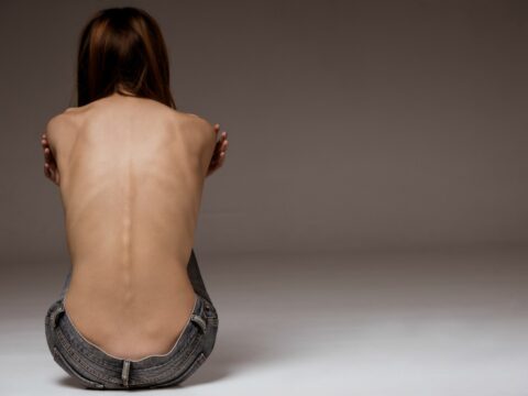 Anoressia: le false credenze e le vere cause