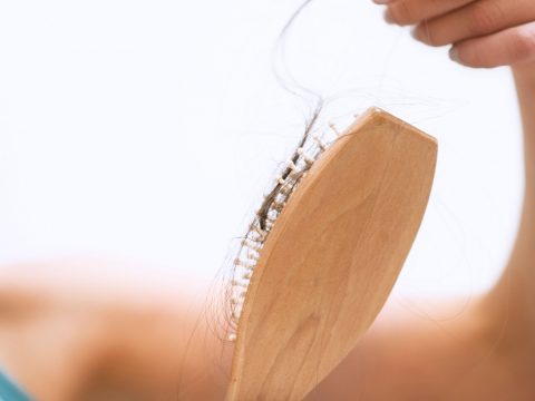 Caduta dei capelli: i rimedi naturali approvati dal dermatologo