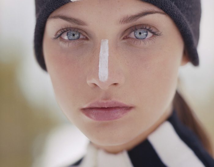 Filtri UV tutto l'anno per prevenire le macchie