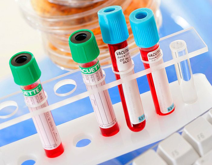Tre nuovi esami medici super rapidi