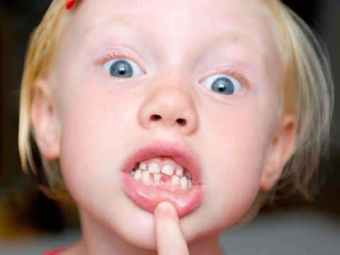 Caduta dei denti da latte: ecco perché è importante
