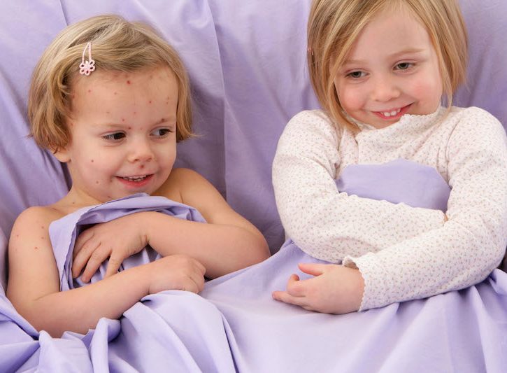 Varicella: come riconoscere i sintomi e come curarla