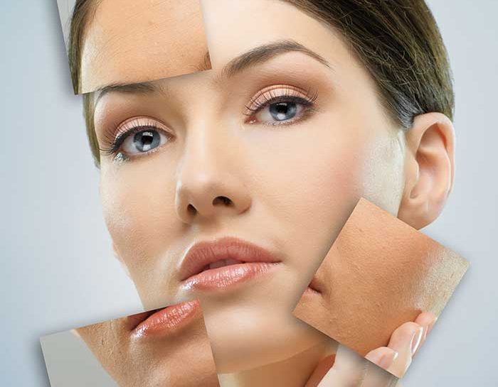 Prova la skin diet, la dieta amica della pelle