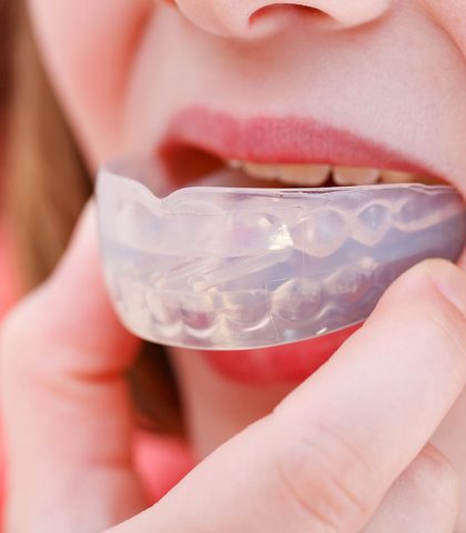 L’apparecchio mobile ai denti riduce o elimina il problema nell’80 per cento dei casi. Il dentis