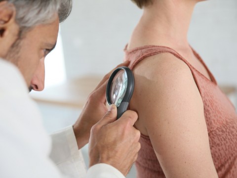 Guarisci dal melanoma se lo riconosci subito