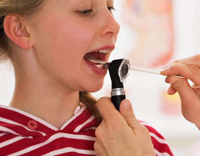 Mononucleosi bambini: sintomi e cure