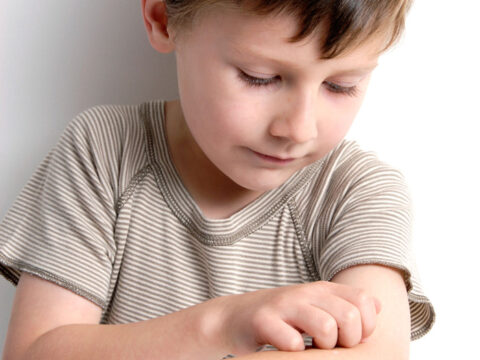 Dermatite atopica nei bambini: sintomi e cure