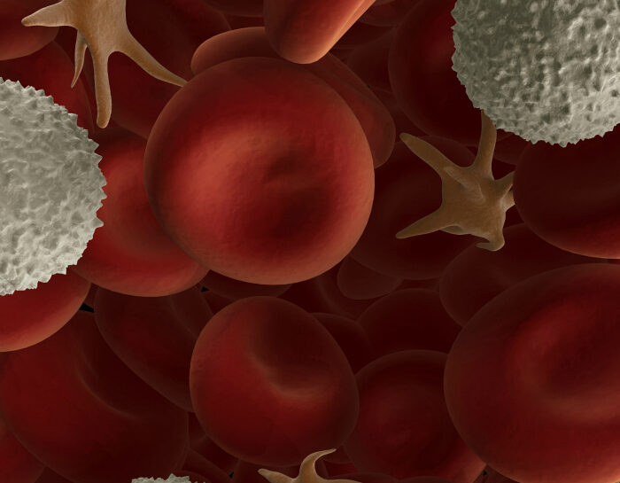 Mononucleosi: diagnosi