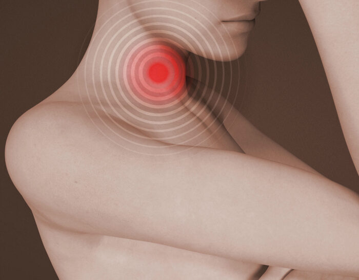 Mononucleosi infettiva: sintomi e cura