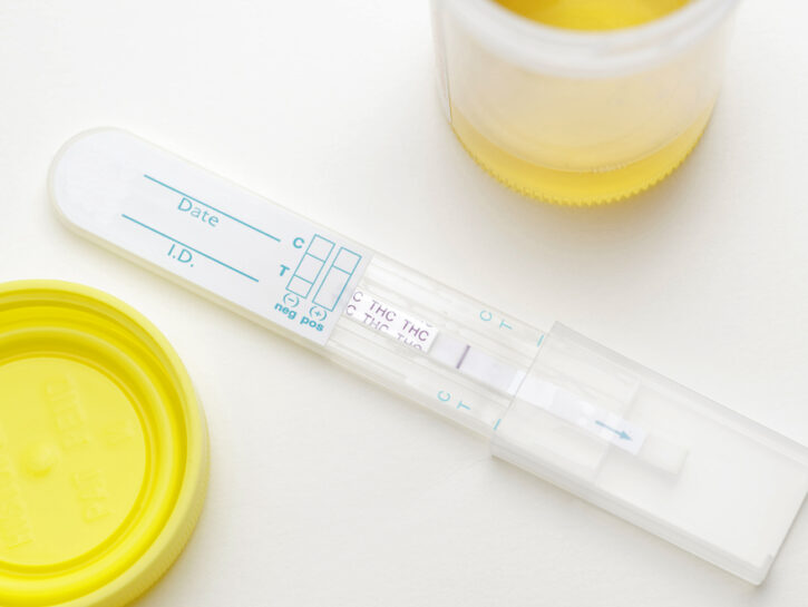 Test antidroga