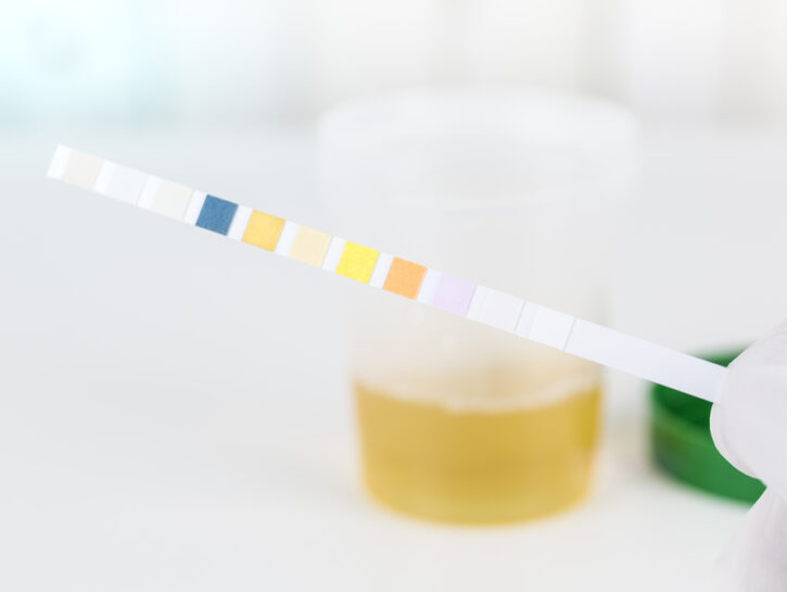 Test urine
