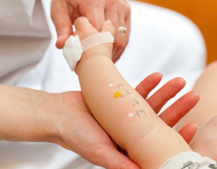 Cosa non mangiare se si è allergici ai pollini