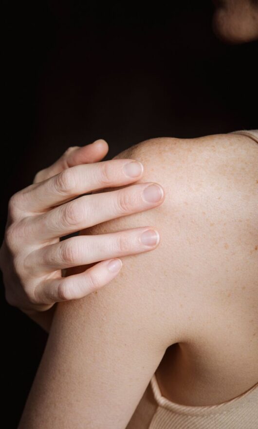 Porri della pelle, cosa fare? I rimedi naturali da provare