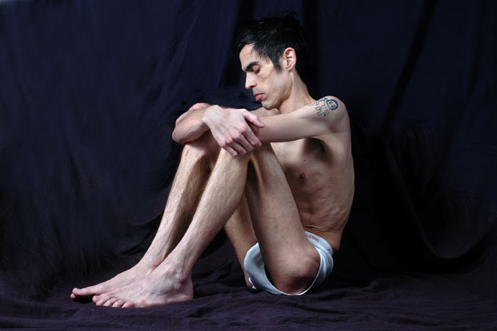 Anoressia: colpisce anche i maschi