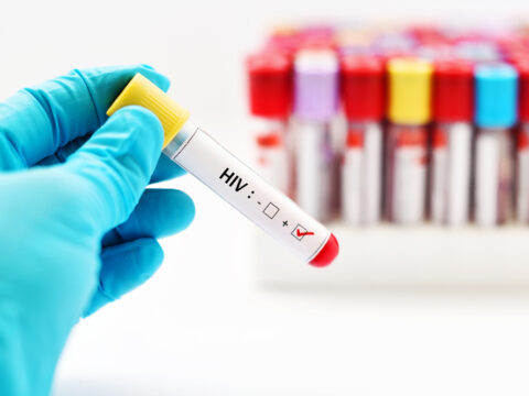 Aids in aumento, 4mila contagi all'anno
