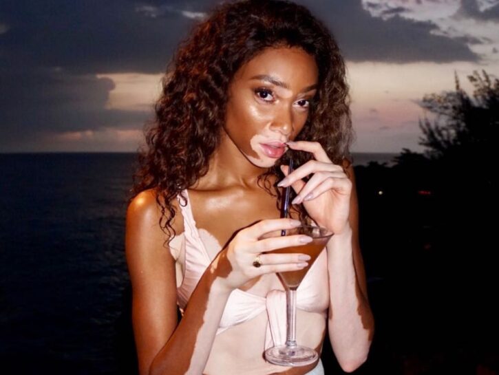 Winnie Harlow risponde alle offese: 