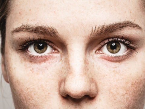 Occhi arrossati: scopri le cause più comuni