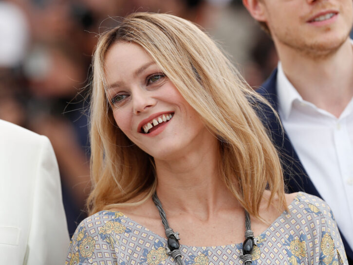 I sorrisi delle star: quando l'imperfezione decreta il successo