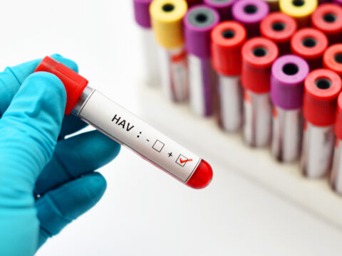 Epatite A: come prevenirla