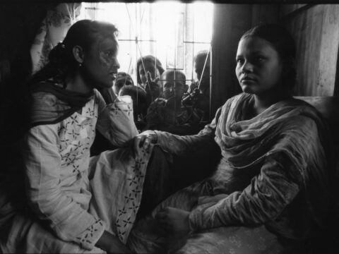 “Volti negati”, in mostra le foto di Ugo Panella sulle donne sfigurate con l’acido