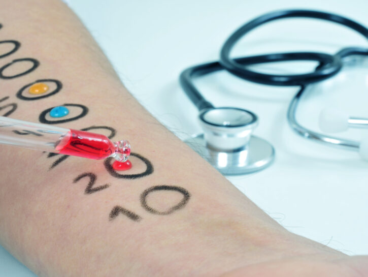 allergie test