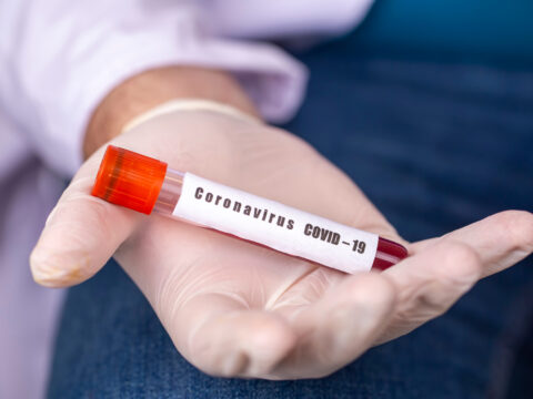 I test proteggono dal contagio di ritorno?