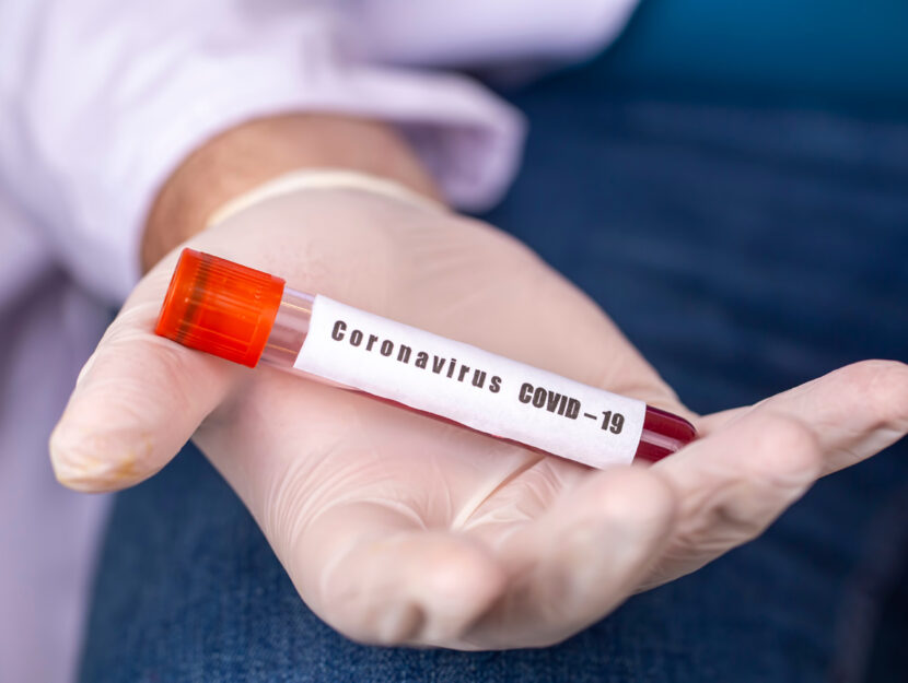 Test coronavirus