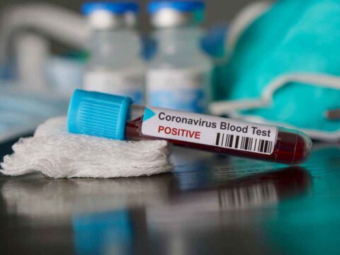 Immunità al coronavirus: quando si ottiene e quanto dura