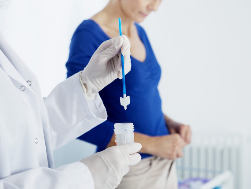 donne pap test