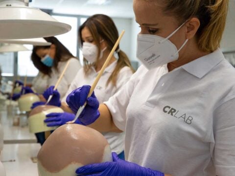 Rinascere con un impianto di capelli veri