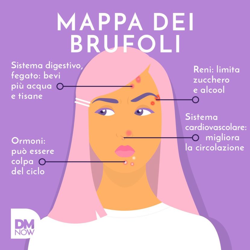 La mappa dei brufoli cosa significa acne su fronte naso o mento