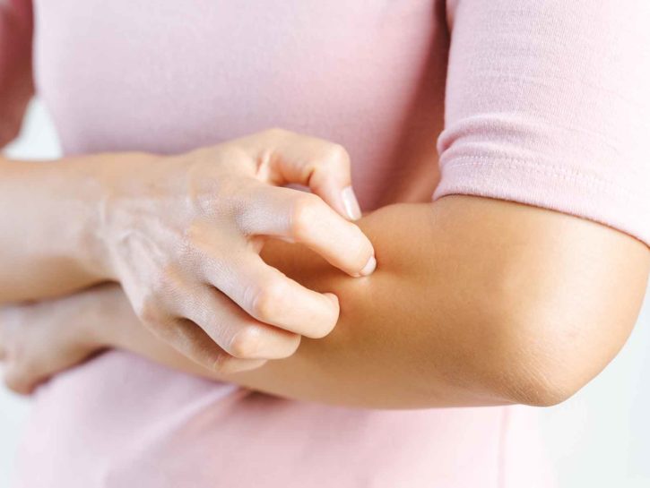 I cibi “amici” contro la psoriasi