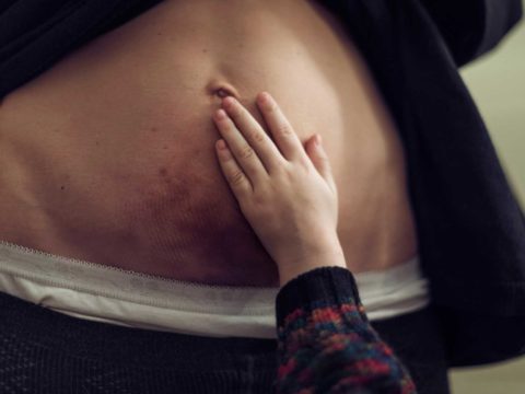 Vulvodinia: cos'è, come si riconosce e si cura