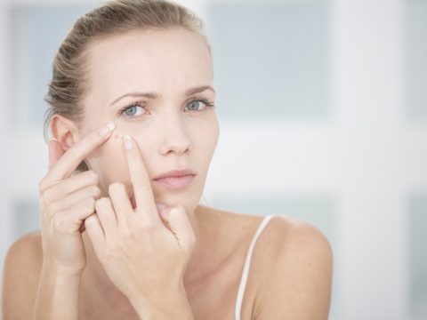 E tu che tipo di acne hai? Ecco come identificarla correttamente