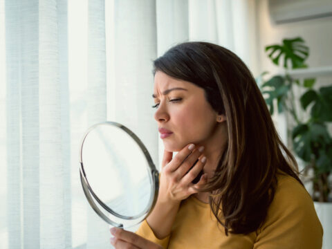 Acne tardiva: quando i brufoli non hanno età