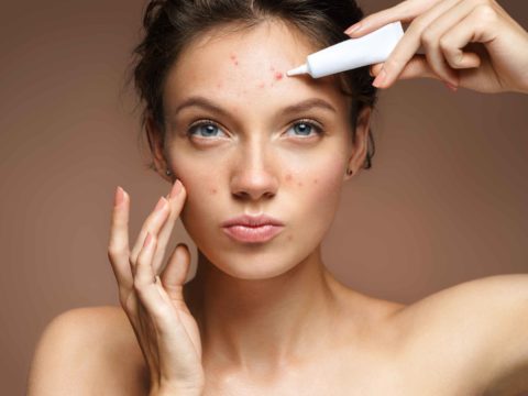 Microbiota della pelle: curalo per guarire dall’acne