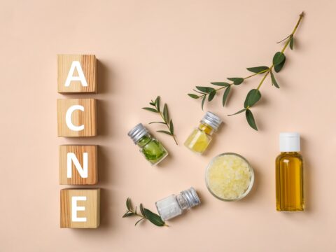 Tutto quello che devi sapere sull'acne