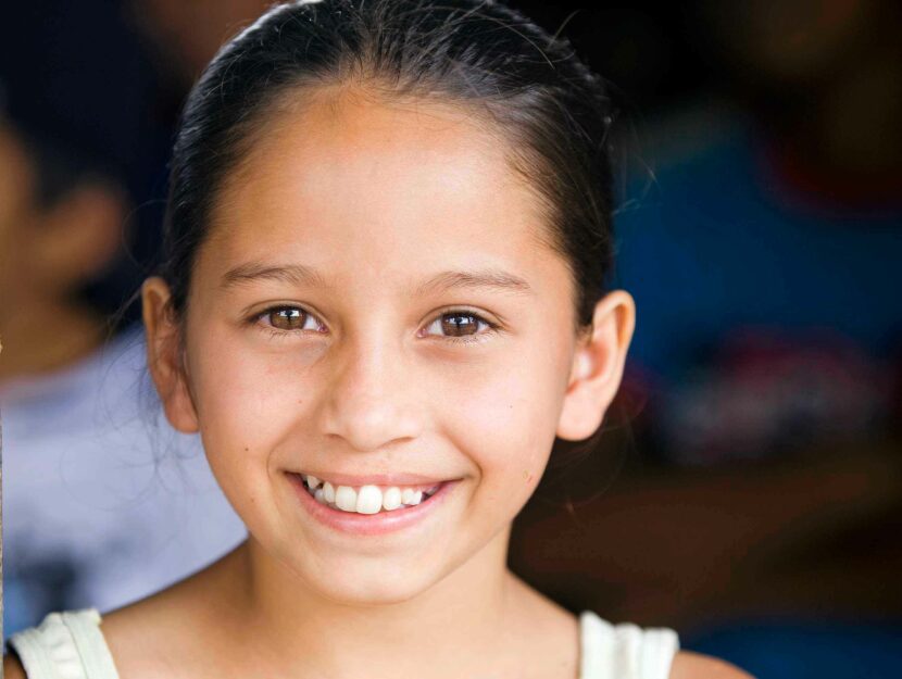 Antonia, una delle migliaia di bambini seguiti nel mondo da Operation Smile: nata con labiopalatosch
