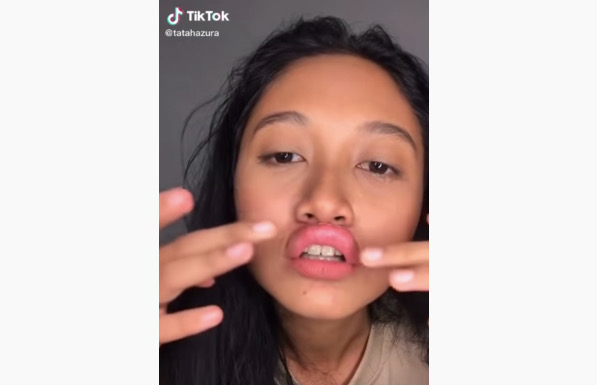 Un esempio del trend #LipFiller su TikTok, in cui una ragazza si tira le labbra con lo scotch per fa