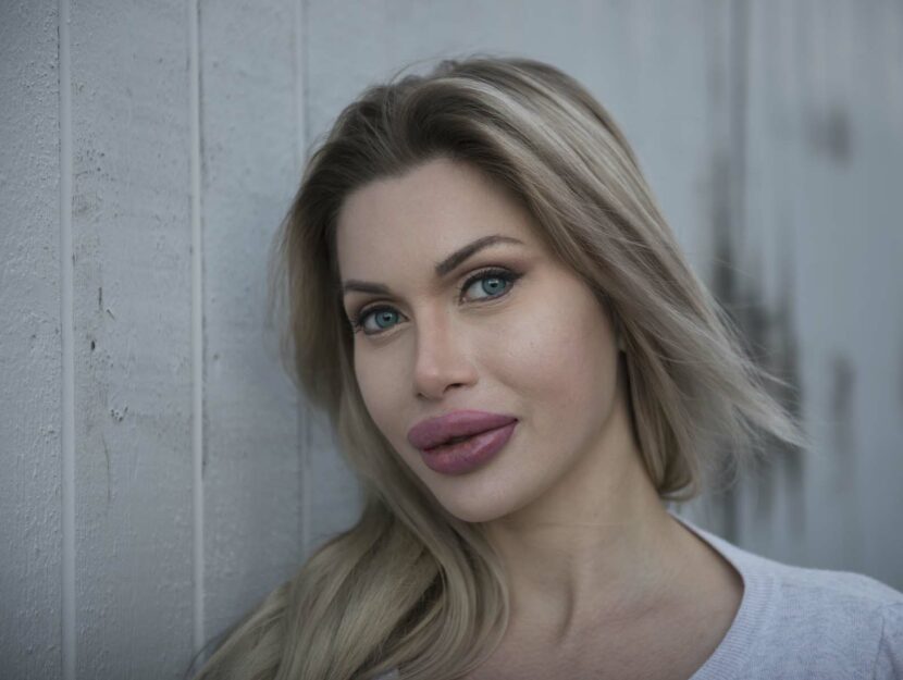 Pixee Fox, 26 anni, svedese, si è sottoposta a più di 200 procedure cosmetiche e interventi chirur