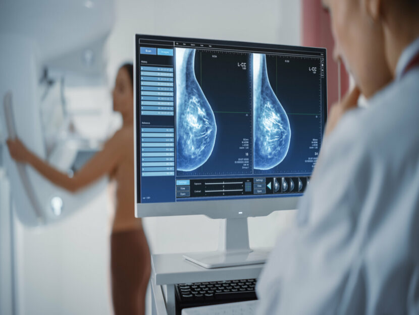 mammografia donne