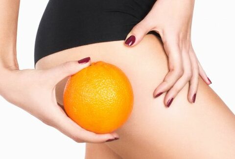 Cellulite e buccia d'arancia: cure e rimedi