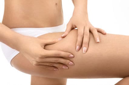 La vera causa della cellulite